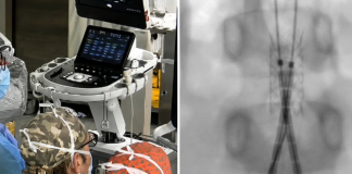 Incidente con un’acquasantiera in chiesa, bimba di 6 anni operata d’urgenza all’aorta a Bari