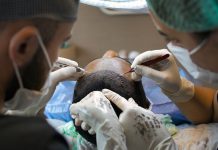 Costo del trapianto di capelli in Turchia: cosa comprende davvero il prezzo e perché la qualità fa la differenza