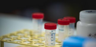 Difterite, quali rischi? Dalla trasmissione alla vaccinazione, ecco cosa sapere