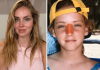 Chiara Ferragni, l’intervento al naso: “Ecco perché è storto ora”