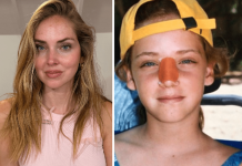 Chiara Ferragni, l’intervento al naso: “Ecco perché è storto ora”
