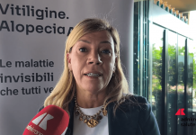Cordella (AbbVie): “Vitiligine e alopecia siano riconosciute da Ssn”