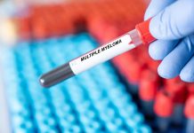 Mieloma multiplo, remissione a 5 anni con terapia Car-T cilta-cel in linee precoci