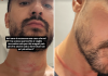 Mr. Daniel, il make-up artist dei vip, aggredito e rapinato a Milano: il racconto choc sui social