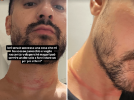 Mr. Daniel, il make-up artist dei vip, aggredito e rapinato a Milano: il racconto choc sui social