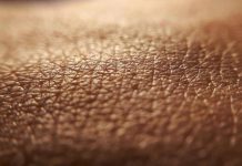 Dermatite atopica, quando la pelle condiziona la vita, ‘Diari atipici’ dà voce ai pazienti