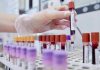 Sclerosi multipla recidivante, Ema raccomanda approvazione ocrelizumab dai 10 anni