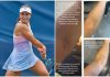 US Open, Stefanini e il livido sul braccio: “Colpa di un controllo antidoping…”