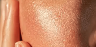 Ai, in Utah prescrizioni per l’acne via app senza intervento del medico
