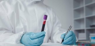 In Francia primo caso umano di virus Shamonda, il paziente è morto: alert Ecdc