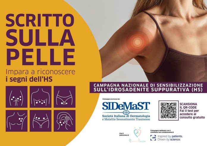 locandina_scritto_sulla_pelle_sidemast