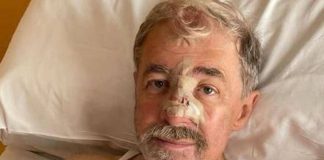Marco Bucci operato al Galliera per la ricostruzione cutanea al naso: “Sto bene”