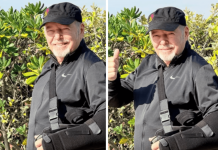Vasco Rossi cade dalla bici e si rompe i legamenti della spalla: “Un’estate di dolori, tengo duro”