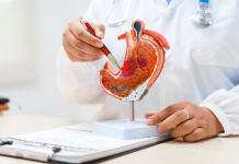 Cancro allo stomaco avanzato, nuova terapia riduce del 42% il rischio di morte 