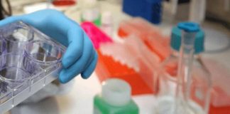 Colite ulcerosa, nuovi dati dallo studio Verdict su vedolizumab