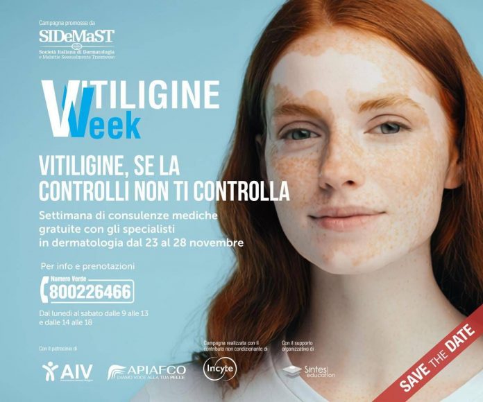 vitiligine_week_locandina_foto_da_sito_sidemast